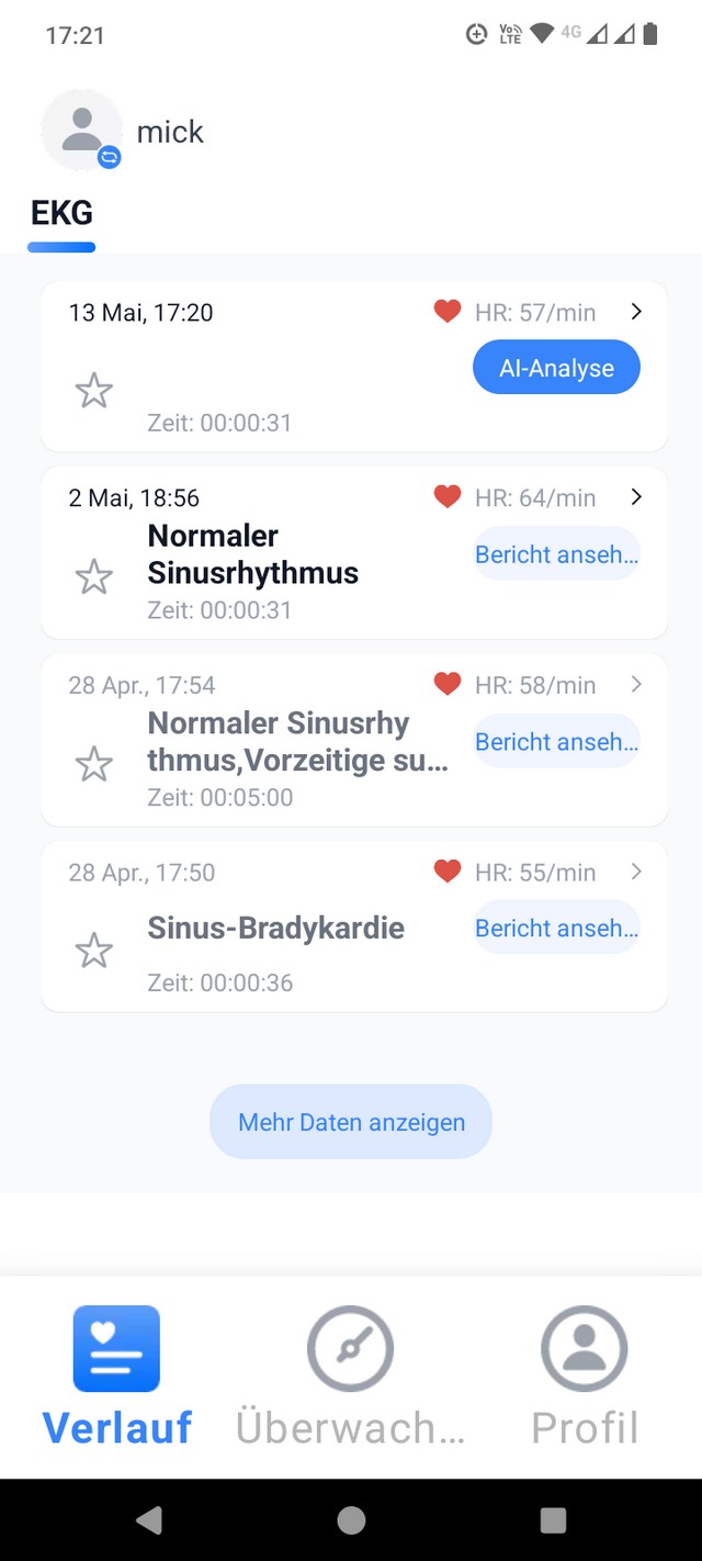 EKG-Auswertungen